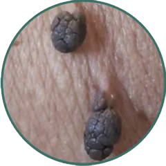 Alt Image