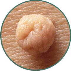 Alt Image