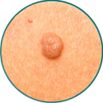 Alt Image